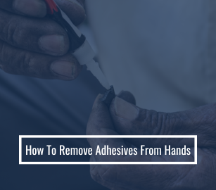 How To Remove Adhesives From Hands