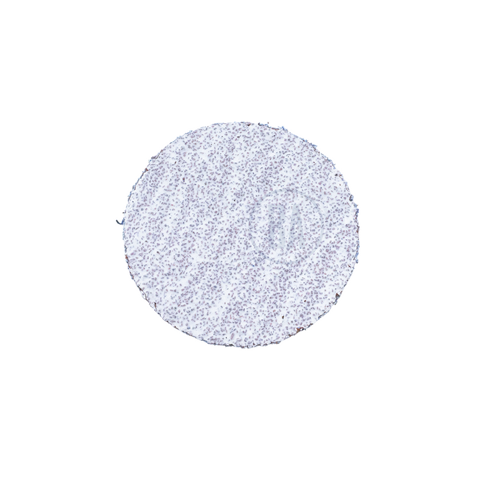 3" Quick Change Discs For Aluminum - 25 Pack